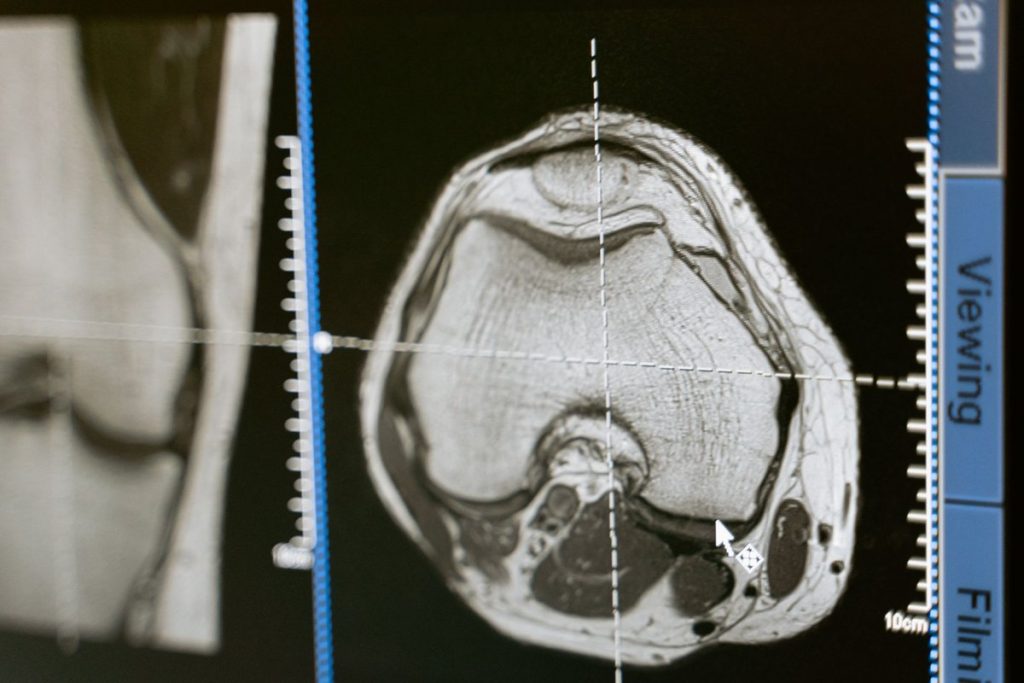 c est quoi un pet scan