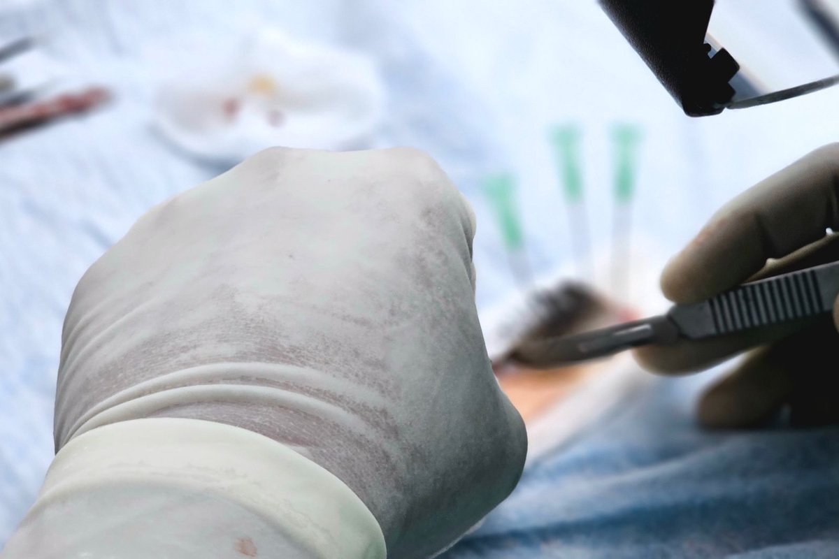 taux créatinine après greffe rein